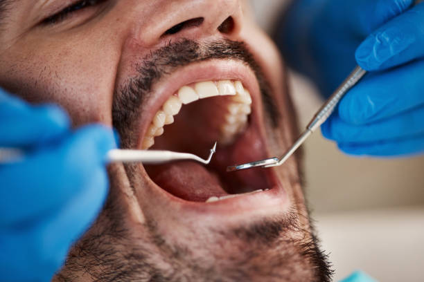 Best Weekend Emergency Dentist in Williamsport, OH